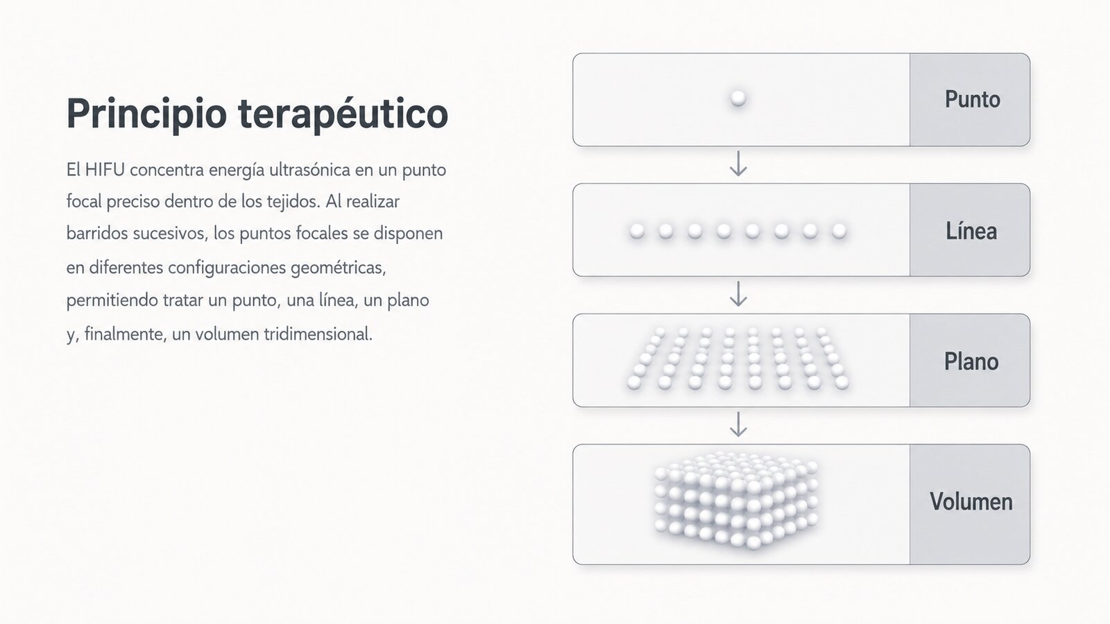 Diagrama de ablación térmica controlada mediante ultrasonido focalizado