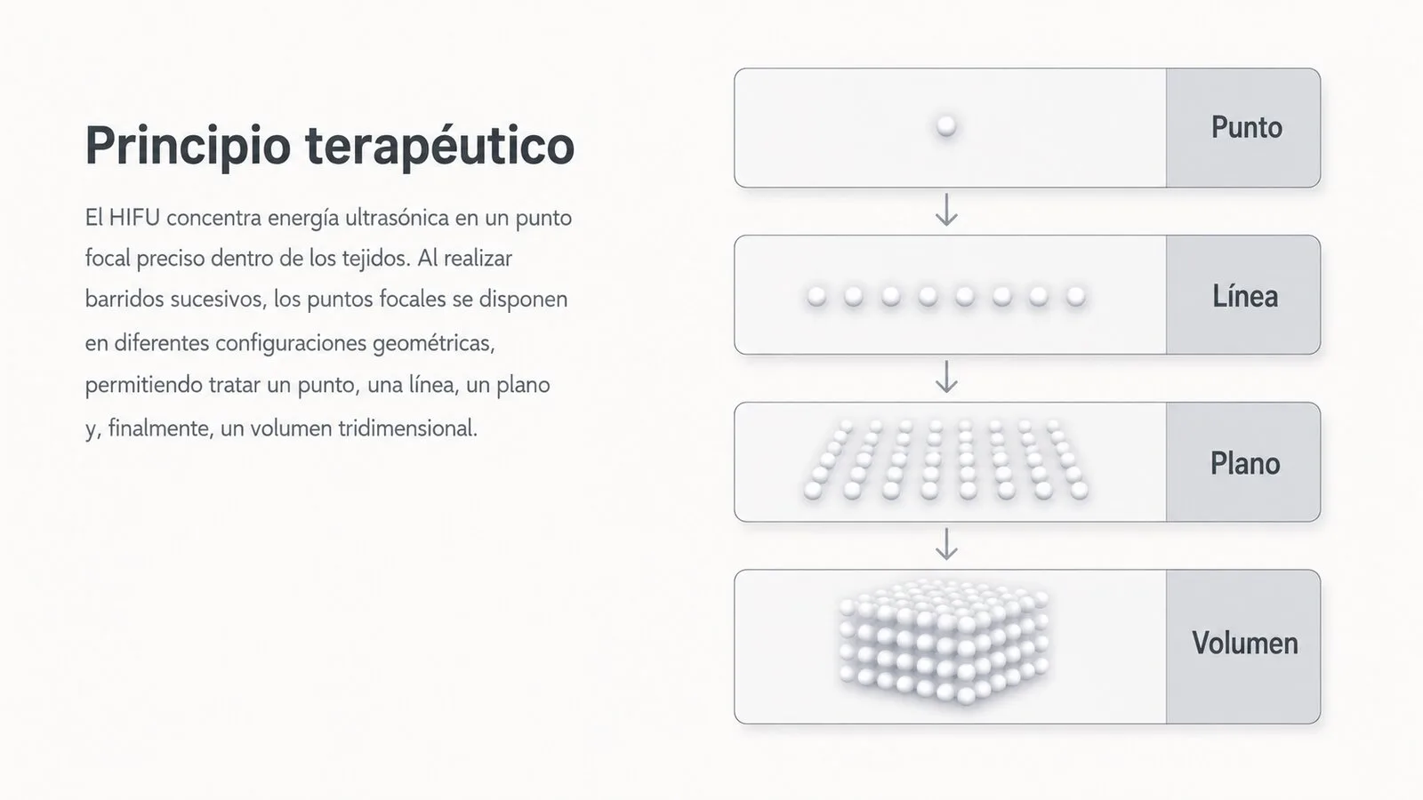 Diagrama de ablación térmica controlada mediante ultrasonido focalizado