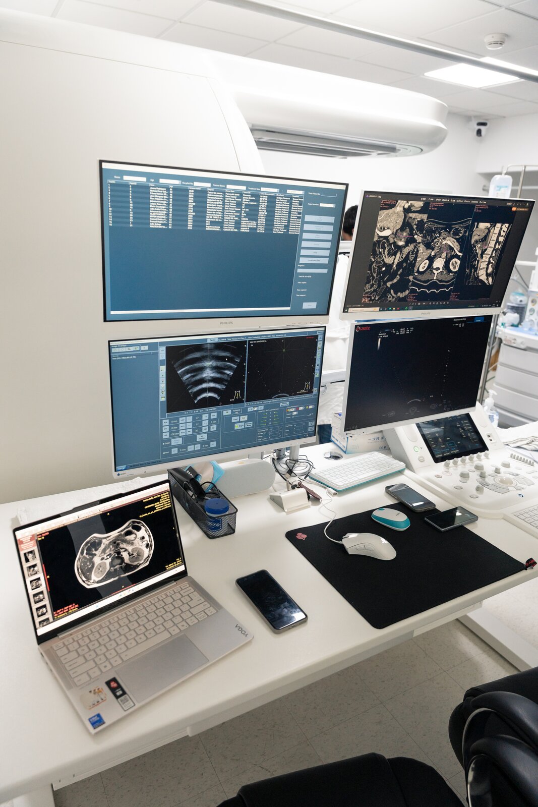 Instalaciones HIFU SUR